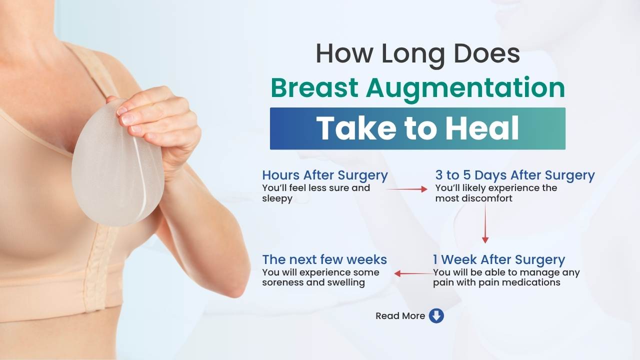 how long does breast augmentation take to heal